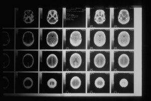 brain scan images